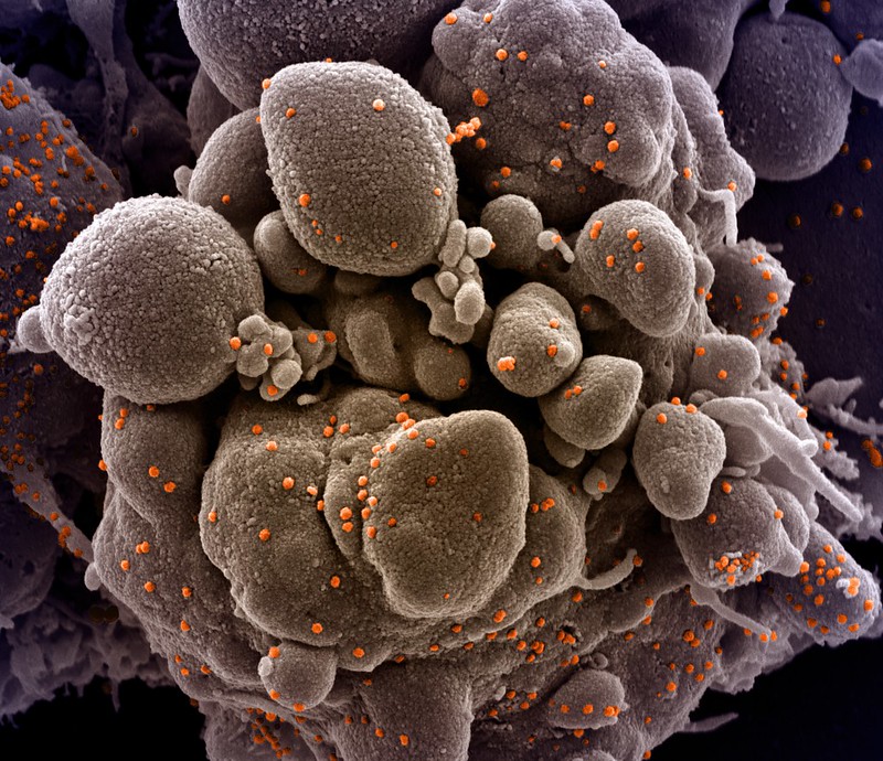 Imagen de ¿Cómo luce realmente el covid-19? Estas son las fotos del coronavirus