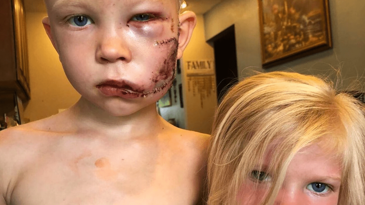 ''Si alguien debía morir, tenía que ser yo'' dice niño héroe que salvó a su hermana del ataque de un perro Imagen de ''Si alguien debía morir, tenía que ser yo'' dice niño héroe que salvó a su hermana del ataque de un perro