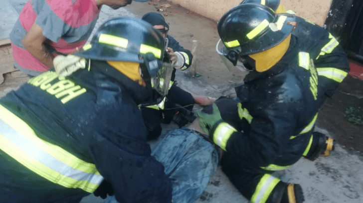 Hombre resulta con quemaduras tras incendio en una casa de la populosa ...