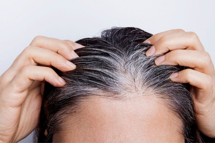Imagen de Conoce por qué salen las canas y cómo evitarlo