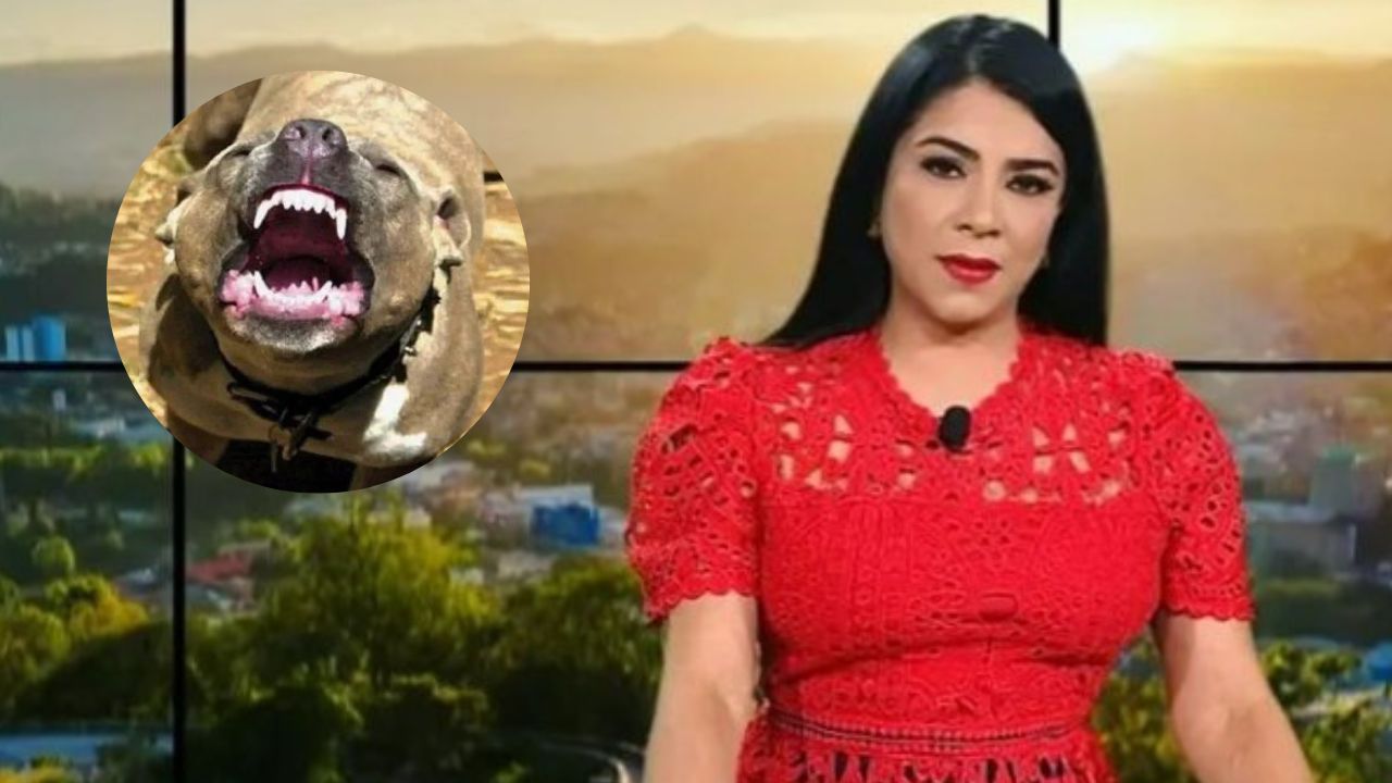 ¡Nuevos detalles! Periodista que fue atacada por un pitbull revela más elementos sobre su estado de salud Imagen de ¡Nuevos detalles! Periodista que fue atacada por un pitbull revela más elementos sobre su estado de salud