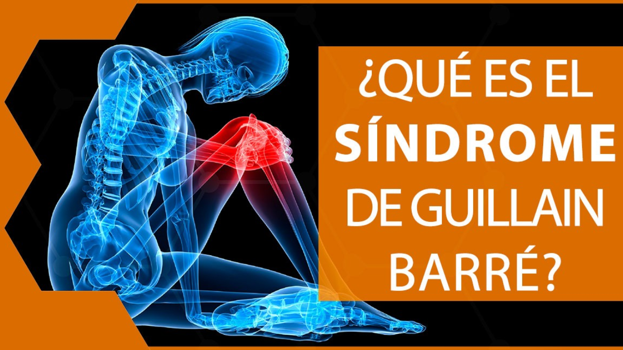 ¿Qué es Guillain Barré?, síntomas, causas y tratamiento Imagen de ¿Qué es Guillain Barré?, síntomas, causas y tratamiento