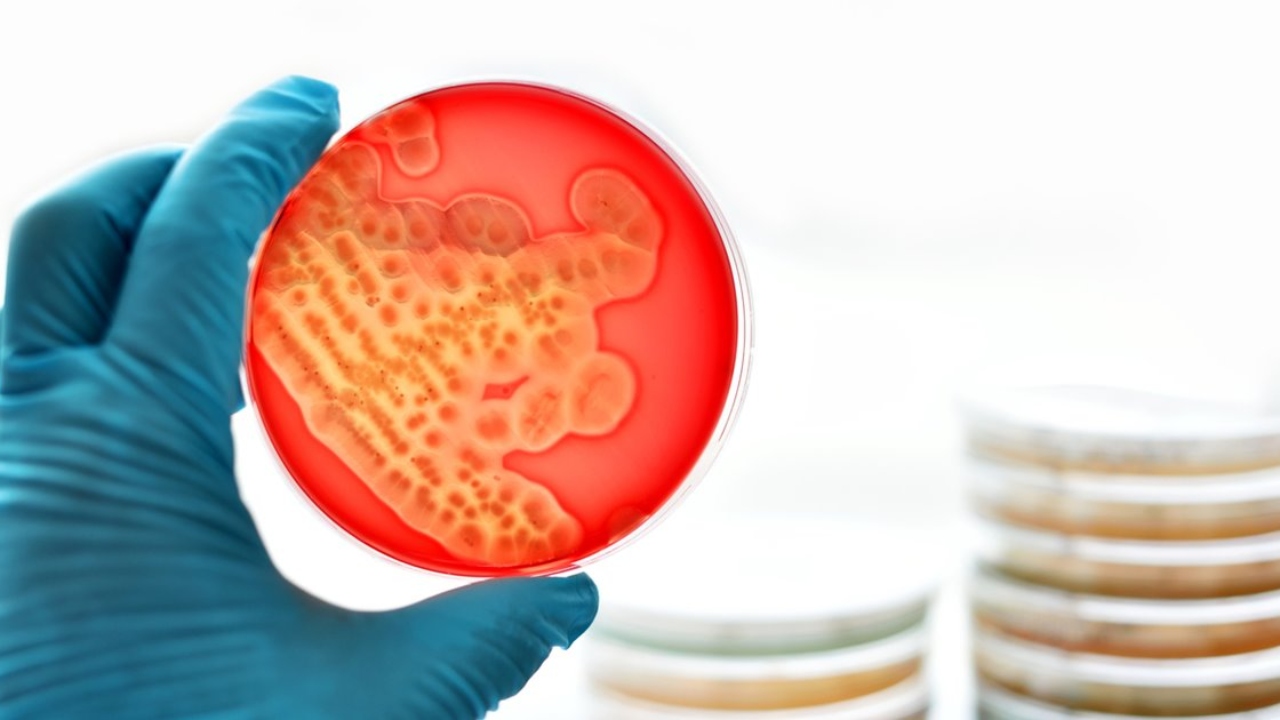 'Superbacterias': ¿Qué son, por qué se llaman así y cuáles son las 12 más peligrosas? Imagen de 'Superbacterias': ¿Qué son, por qué se llaman así y cuáles son las 12 más peligrosas?