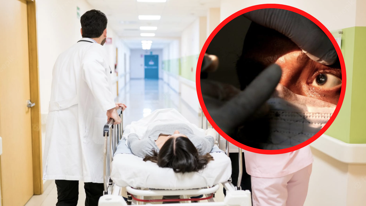 Imagen de Hongo negro síntomas, ¿cuáles son las señales de alerta y los tratamientos de esta enfermedad?