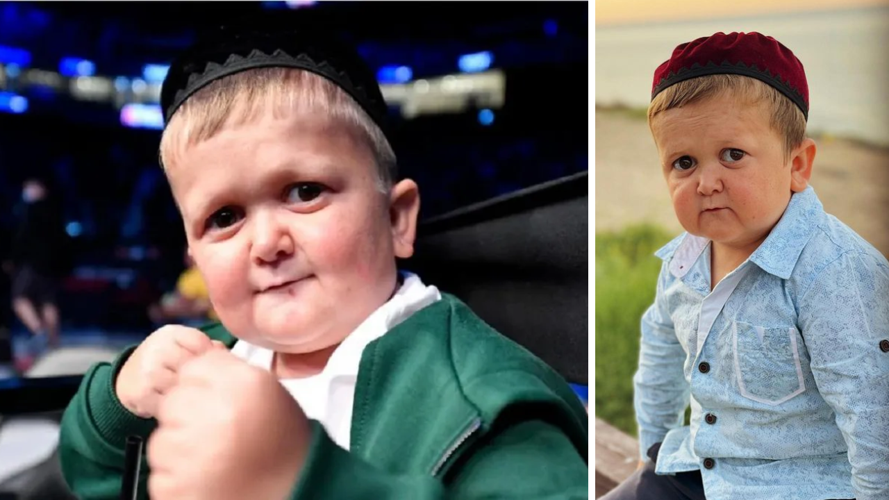 Hasbulla Magomédov, quién es, edad y la enfermedad acondroplasia que sufre la estrella de internet Imagen de Hasbulla Magomédov, quién es, edad y la enfermedad acondroplasia que sufre la estrella de internet