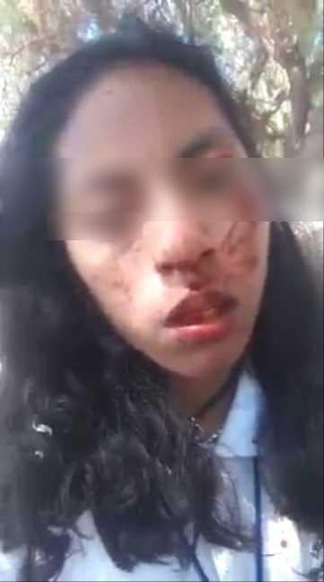 Norma Lizbeth fue llevada a un centro de salud por la gravedad de sus golpes. Foto: Facebook