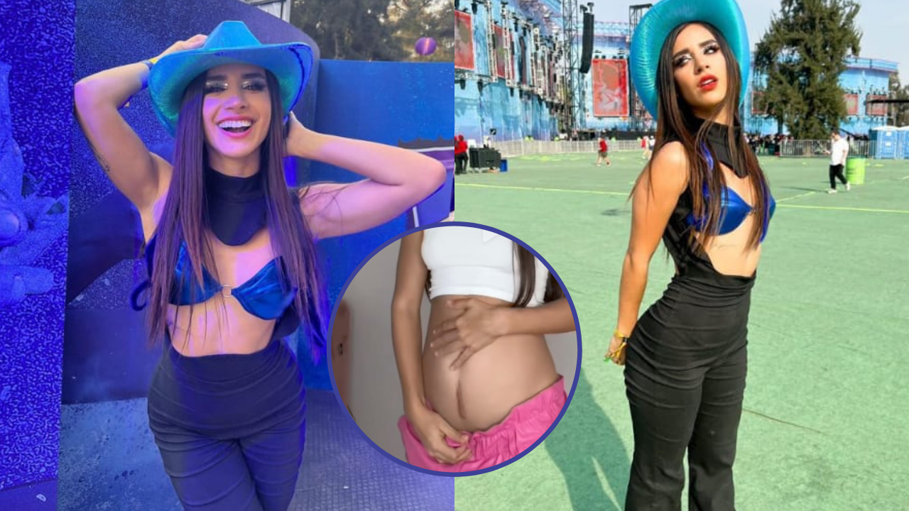 Imagen de Cicatriz de Tammy Parra, la tiktoker que está en tendencia en redes sociales
