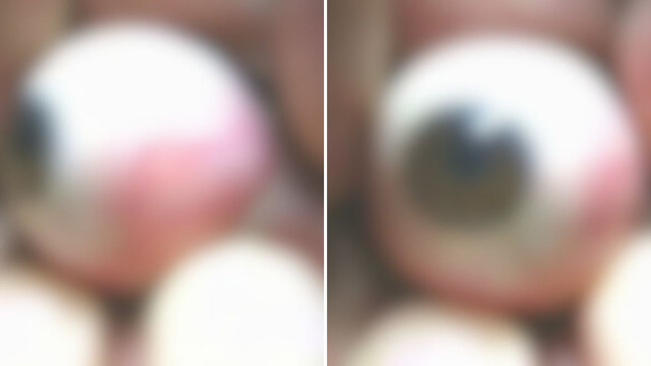 Aunque no se saca el órgano, el hombre se deja el ojo descubierto. Foto: Captura de pantalla