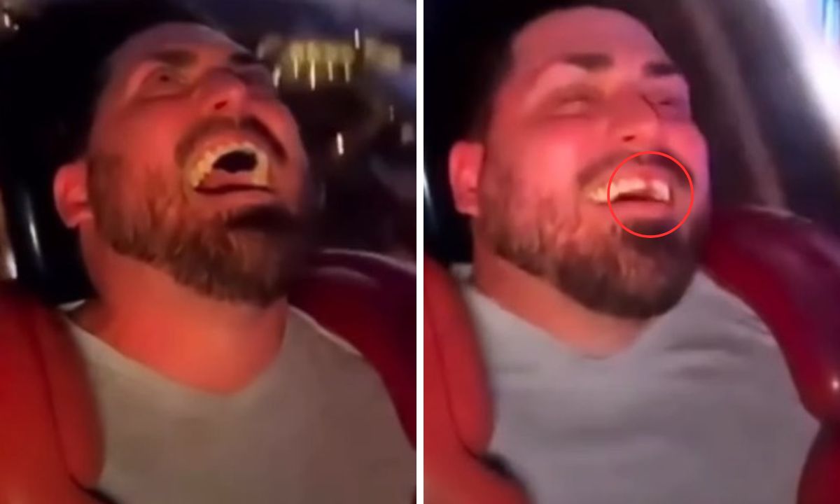VIDEO: En plena cita, hombre pierde un diente en juego mecánico Imagen de VIDEO: En plena cita, hombre pierde un diente en juego mecánico