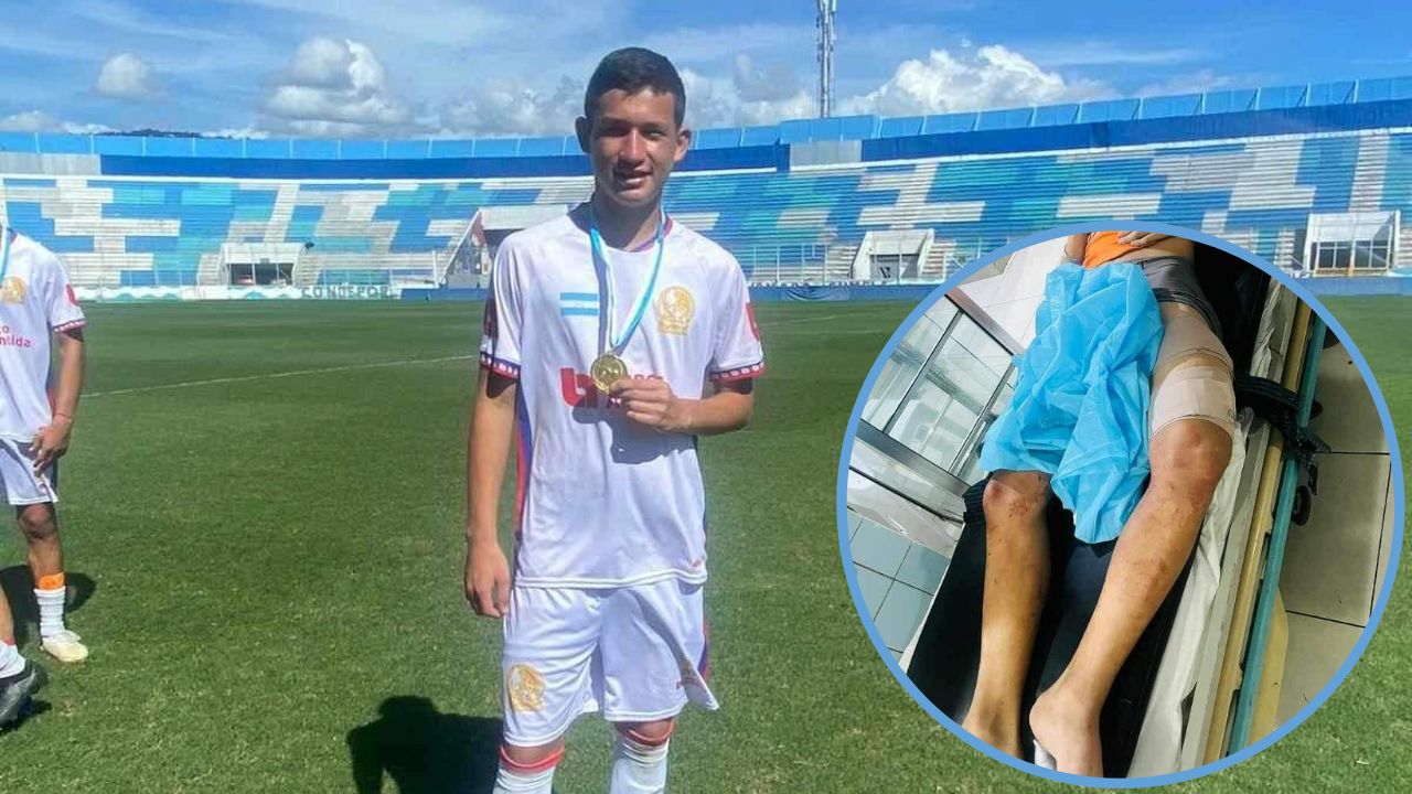 Balean a futbolista hondureño por robarle motocicleta; necesita operación Imagen de Balean a futbolista hondureño por robarle motocicleta; necesita operación
