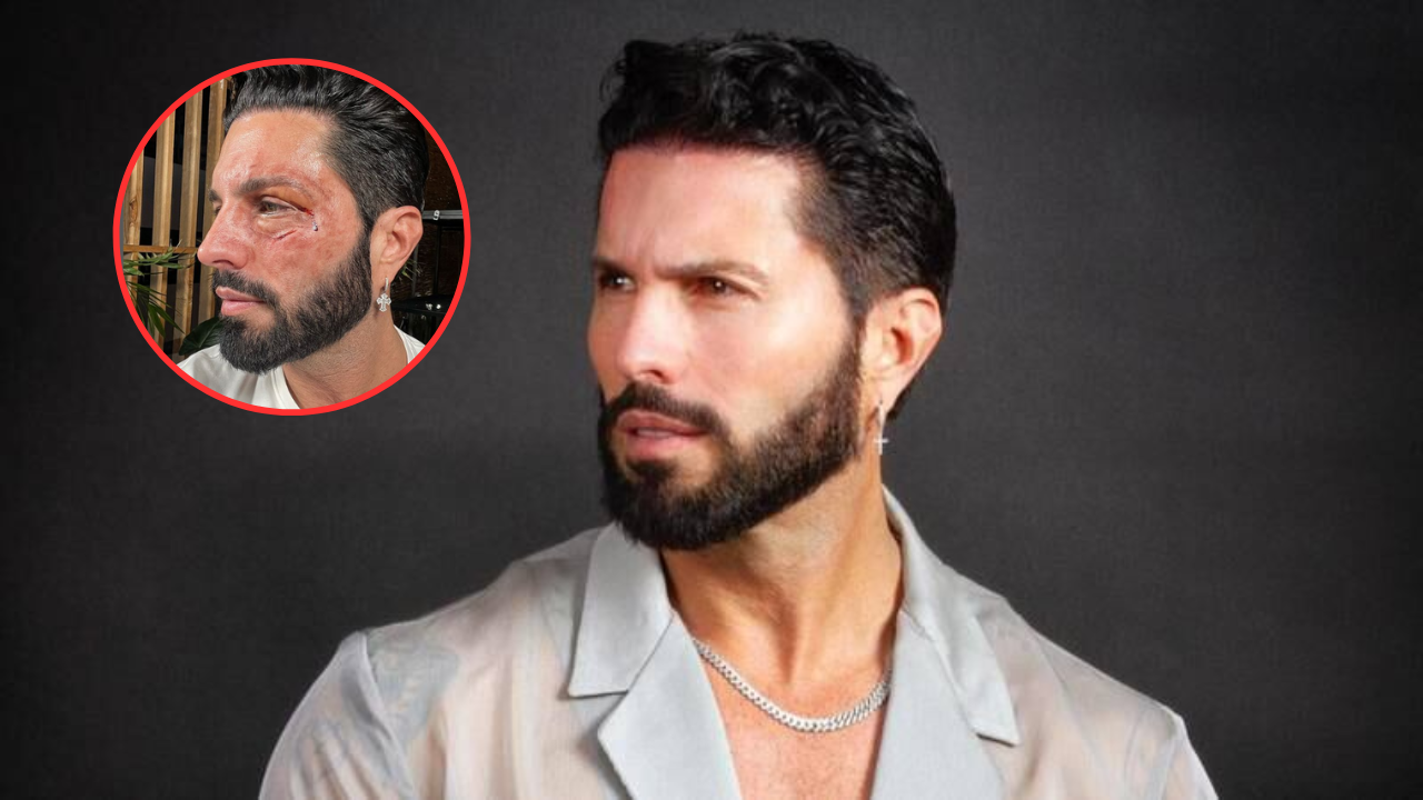 ¿Qué le pasó a Poncho Denigris?, el influencer mexicano subió imagenes que preocuparon a sus seguidores Imagen de ¿Qué le pasó a Poncho Denigris?, el influencer mexicano subió imagenes que preocuparon a sus seguidores