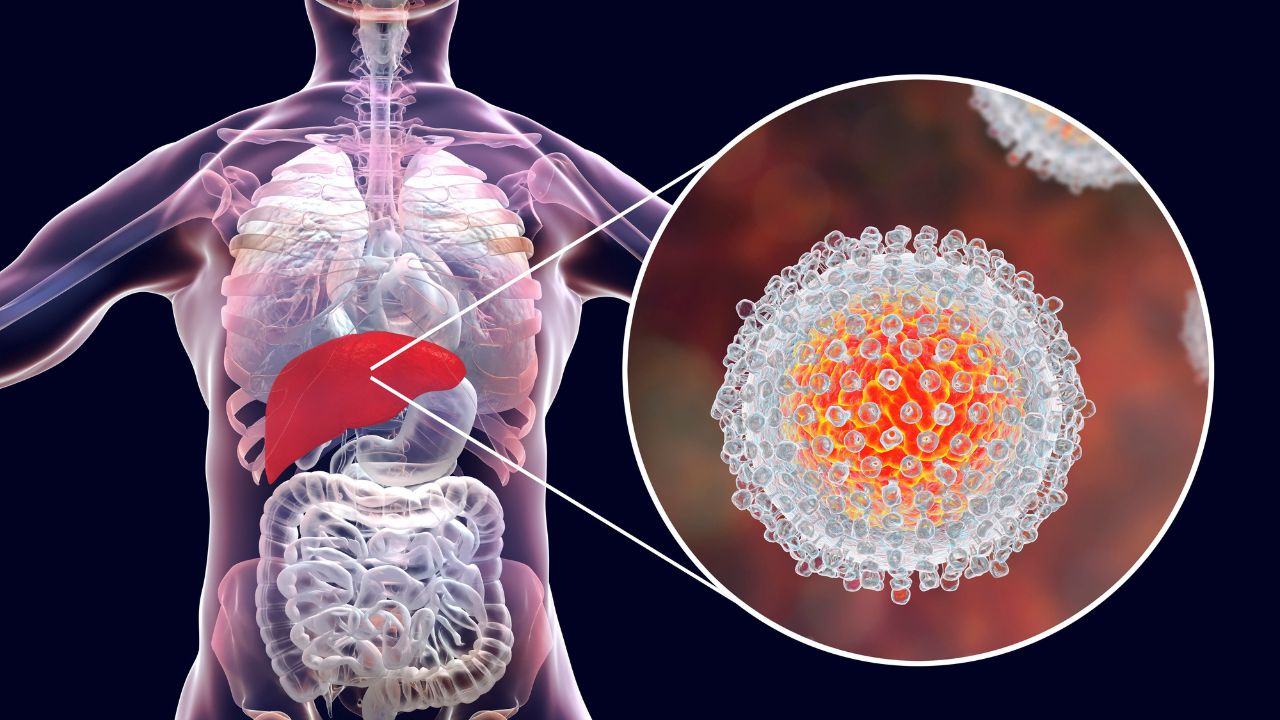 Imagen de El virus de la hepatitis mata a 3,500 personas por día, según la OMS