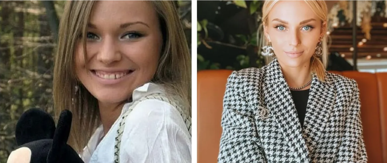 Antes y después de una persona