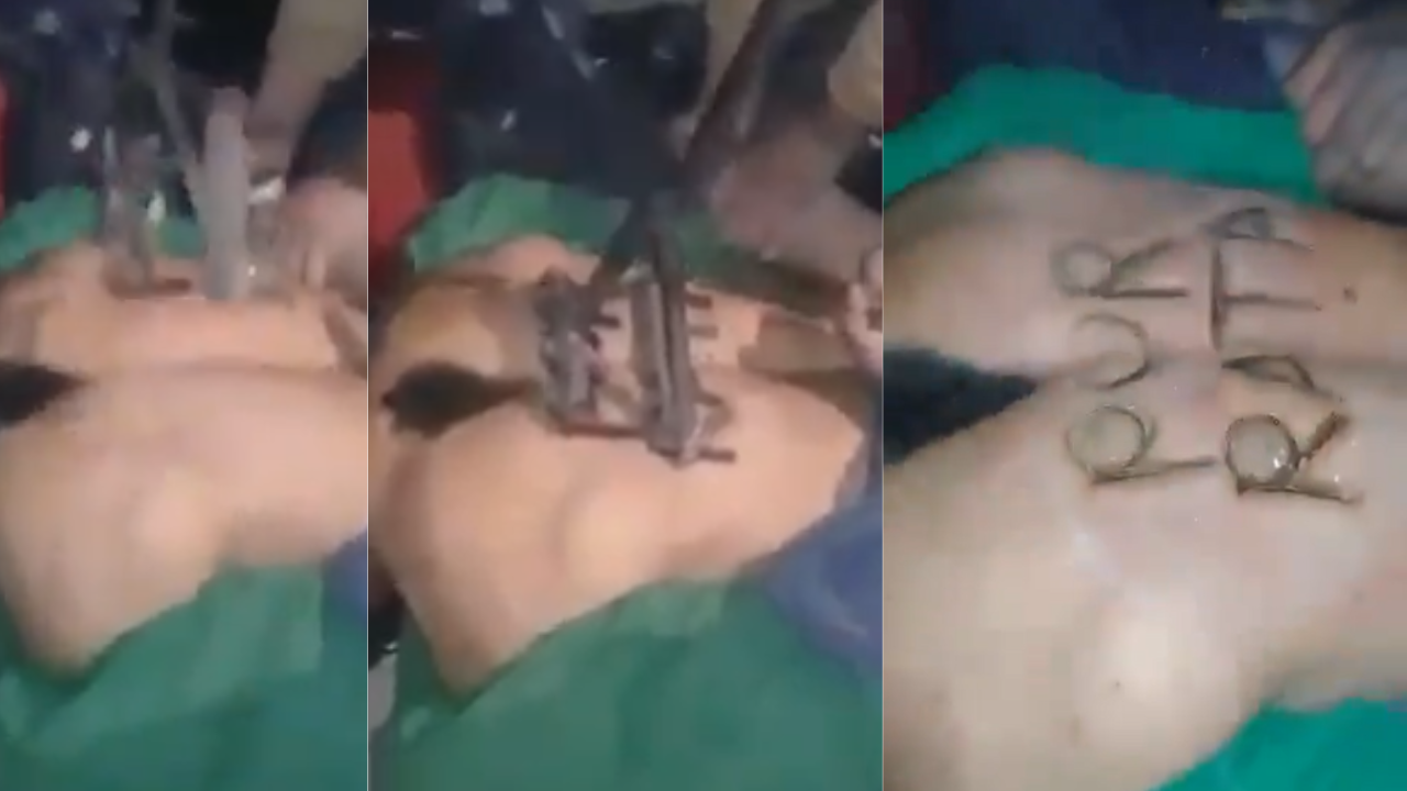 'Por rata' marcan a un hombre como ganado tras acusarlo de robo Imagen de 'Por rata' marcan a un hombre como ganado tras acusarlo de robo