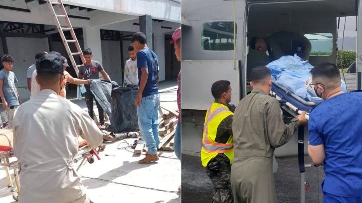 Ceibeño sufre quemaduras de tercer grado tras descarga eléctrica