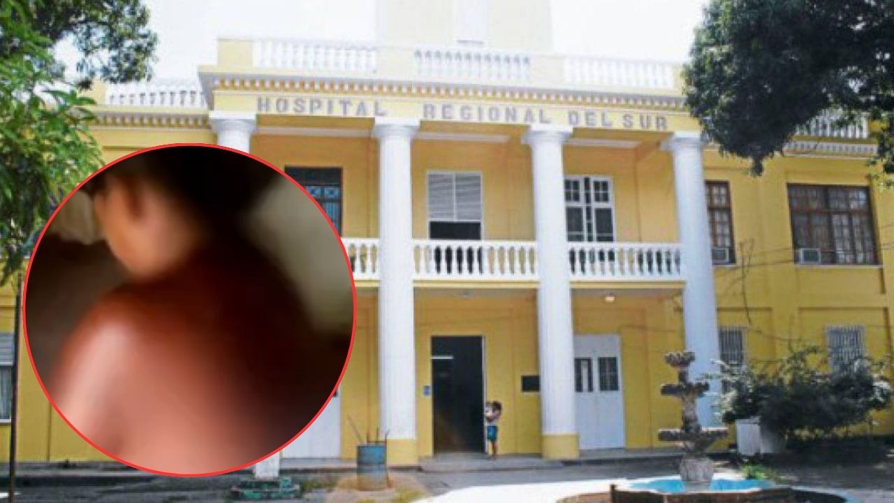 Suegra quemó a su nuera con agua hirviendo en Choluteca Imagen de Suegra quemó a su nuera con agua hirviendo en Choluteca