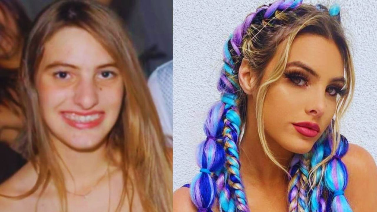 Lele Pons antes y después, en la imagen de la izquierda aparece como era antes, y en la imagen de la derecha, como es actualmente. 