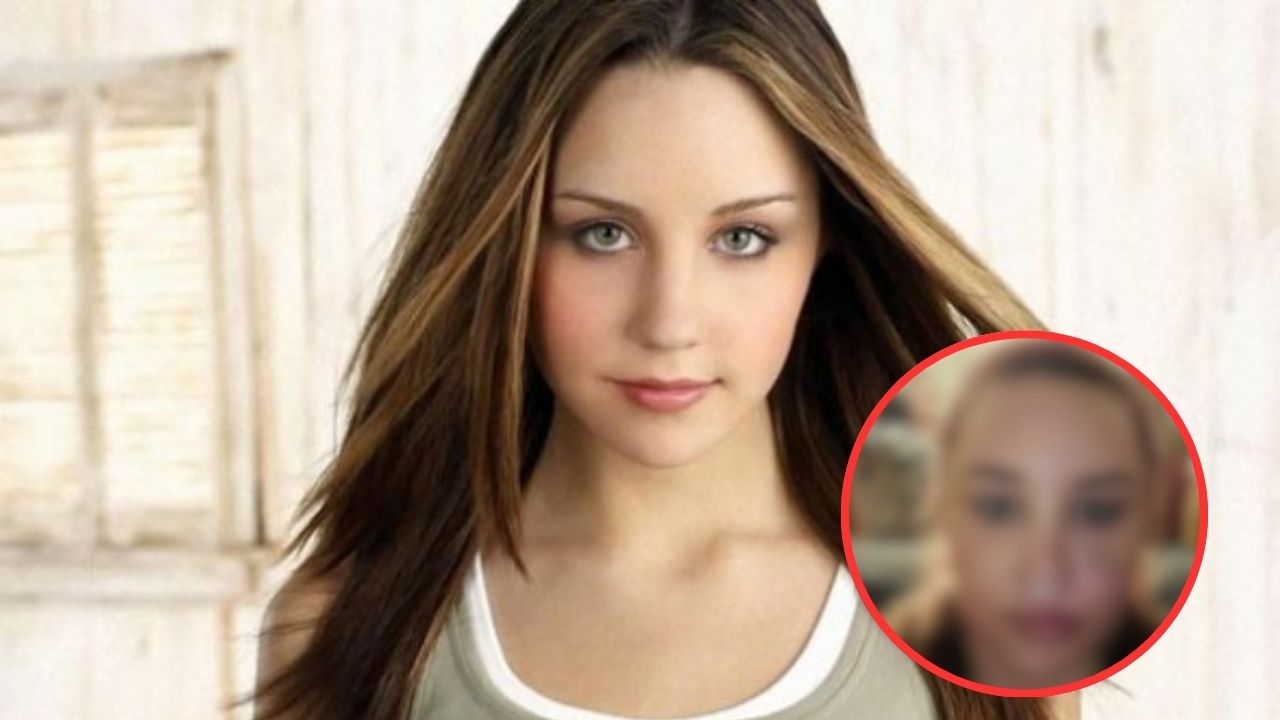 El impactante cambio de Amanda Bynes: ¿qué le ocurrió? Imagen de El impactante cambio de Amanda Bynes: ¿qué le ocurrió?