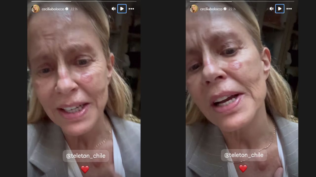 Capturas de pantalla de la historia de Cecilia explicando sobre sus lesiones, ella está vestida con saco gris y blusa blanca.