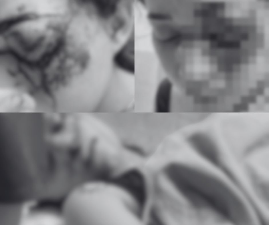 Foto de Melanie en el hospital en donde se puede ver las graves heridas que le dejó su novio Christian al golpearla brutalmente