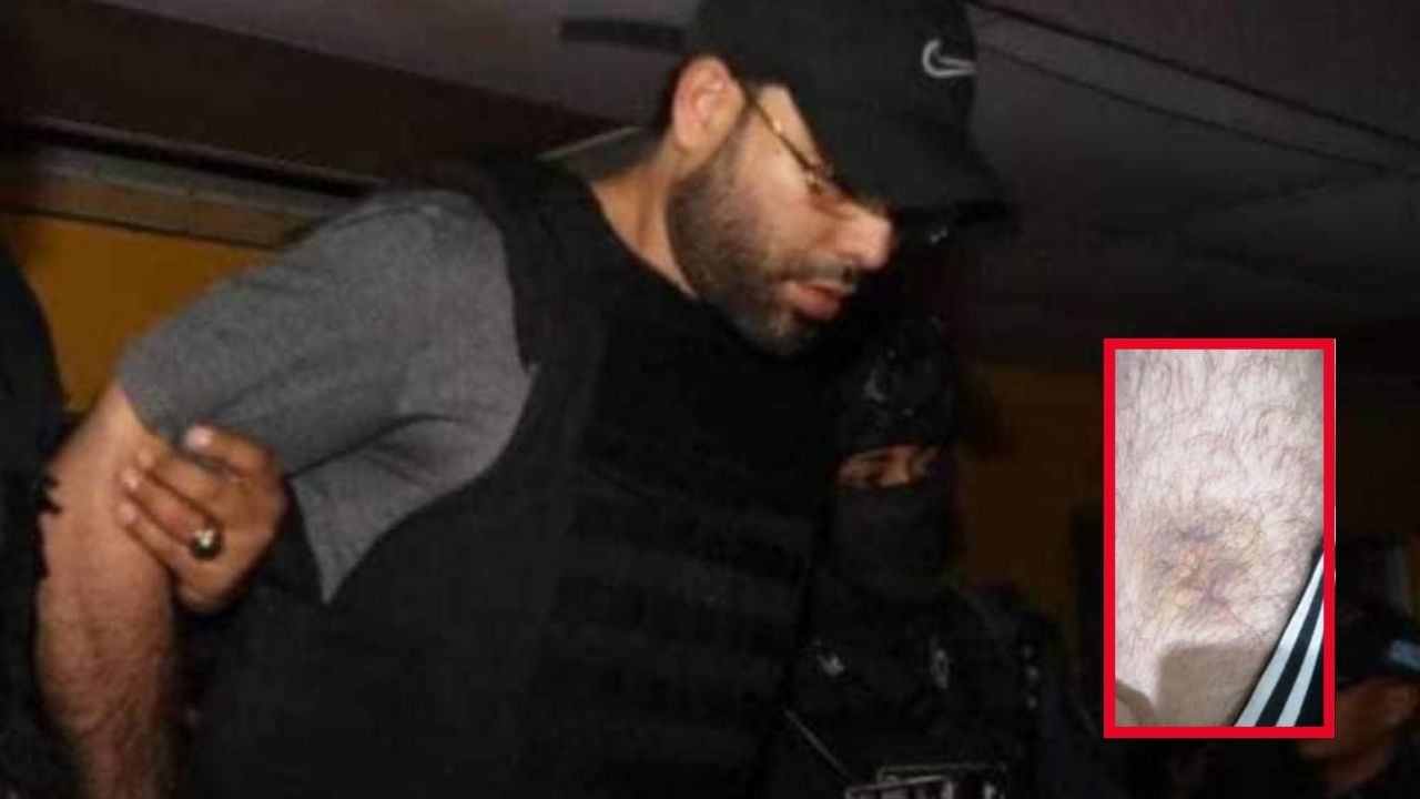 Gilbert Reyes dice que está orinando sangre tras golpiza en prisión Imagen de Gilbert Reyes dice que está orinando sangre tras golpiza en prisión
