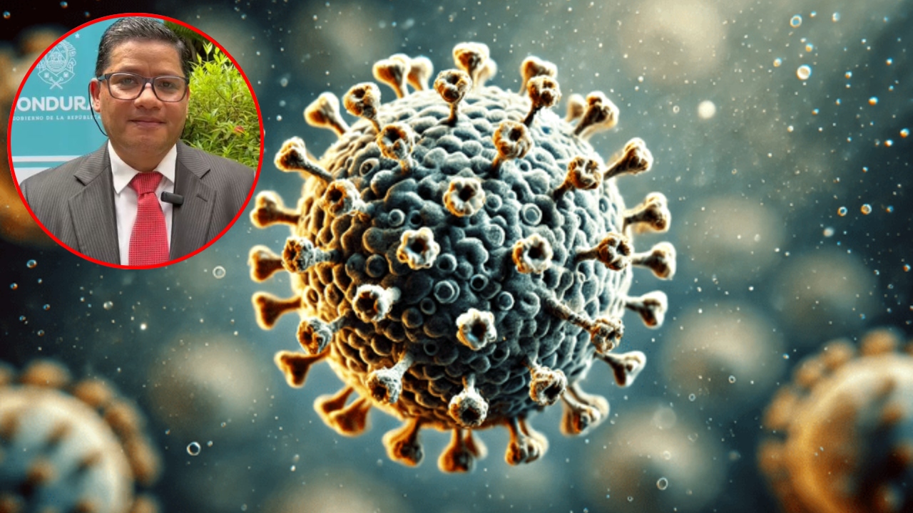 Imagen de ¿Ya hay casos de metapneumovirus en Honduras?, esto dice la Sesal