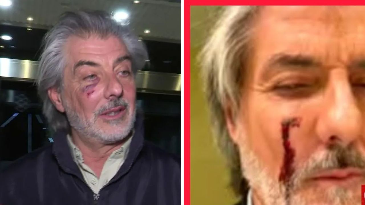 Foto de Jaime Ostos Jr. con el ojo golpeado por su hermano Jacobo Ostos