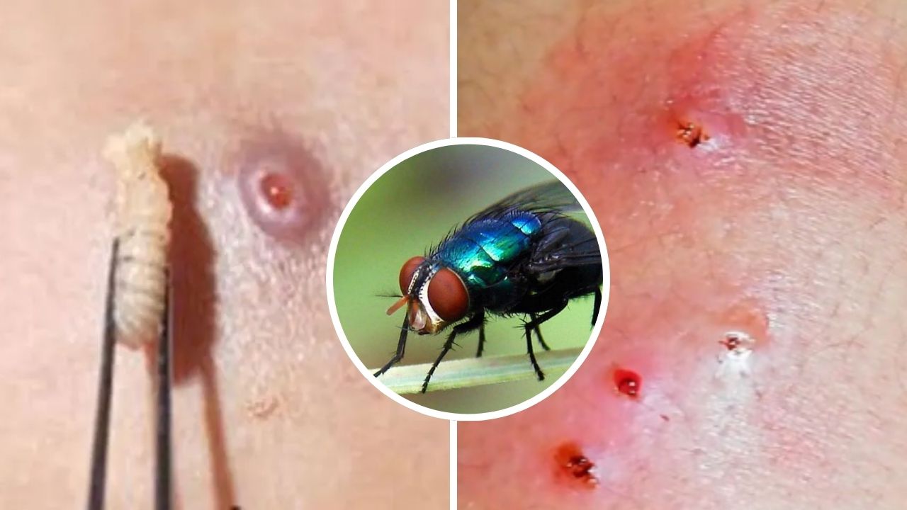 Collage de fotos de como se ve una picadura en humanos del gusano barrenador 