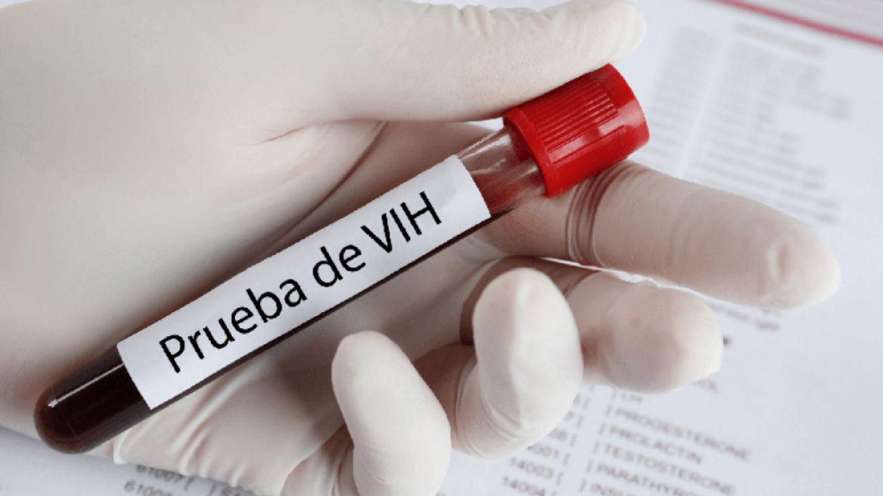 Conadeh insta a la población hondureña a practicarse prueba de VIH Imagen de Conadeh insta a la población hondureña a practicarse prueba de VIH