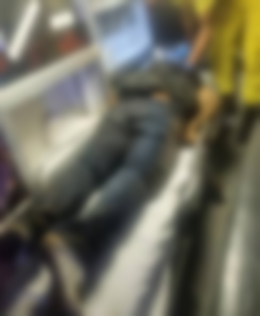 Foto del hombre que fue atacado por su pareja celosa 