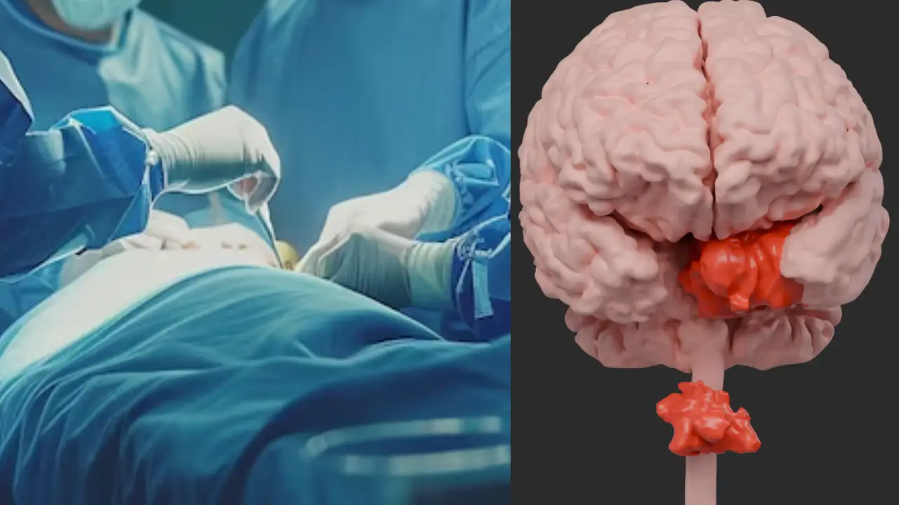 Joven tenía un tumor 'intratable' en la columna: se lo extrajeron por un ojo Imagen de Joven tenía un tumor 'intratable' en la columna: se lo extrajeron por un ojo