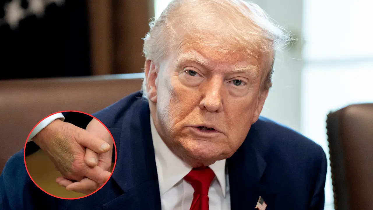 Imagen de ¿Cuál es la enfermedad con la que fue diagnosticado Donald Trump?