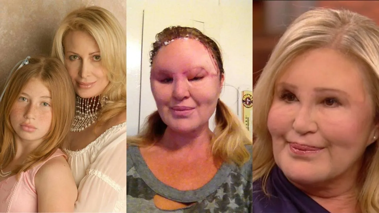 Cambios en el rostro de Carol Bryan.