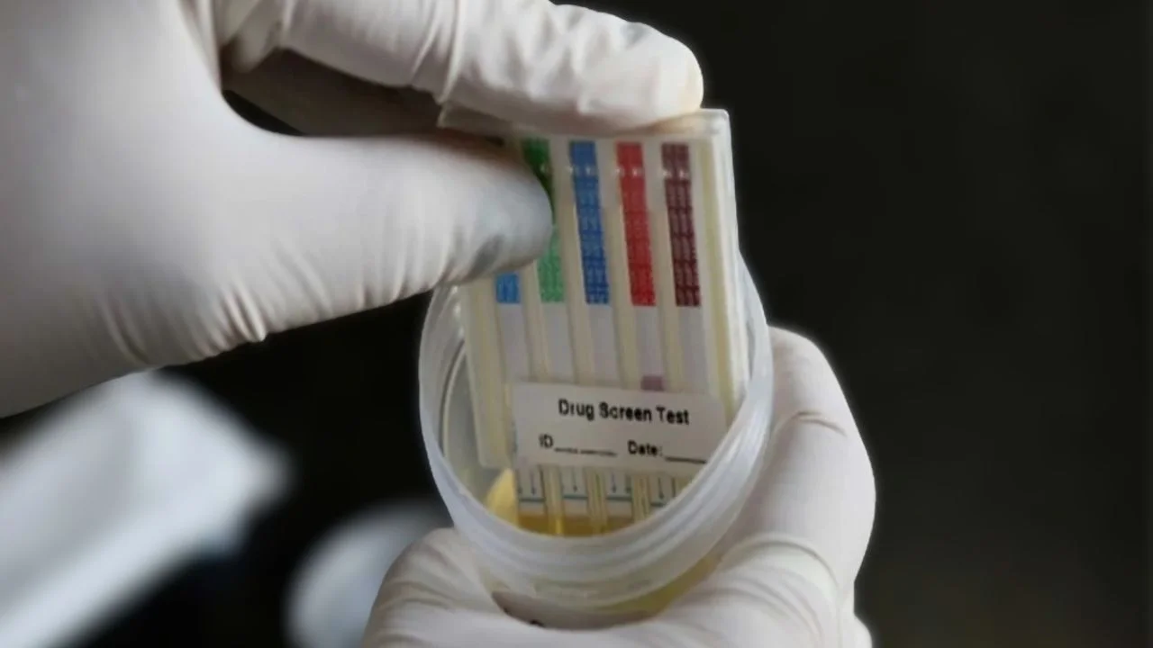 Imagen de Un 6 % de solicitantes de licencia pesada dan positivo a prueba antidoping