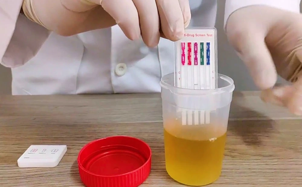 Imagen de referencia de pruebas antidoping.