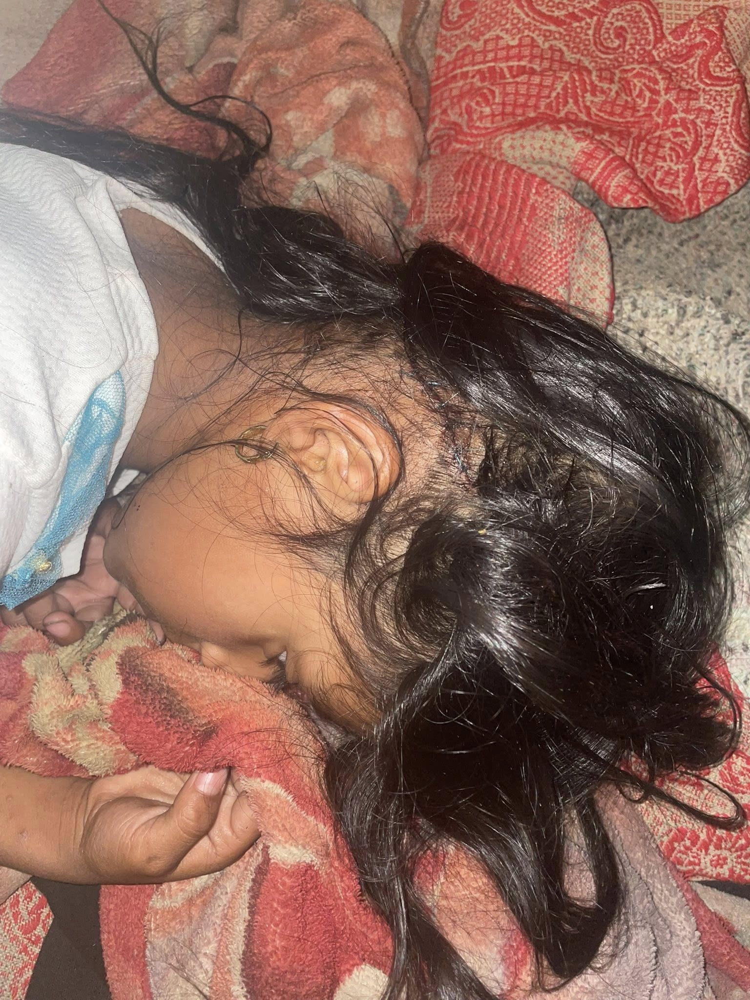 Foto de la niña por la que claman ayuda tras sufrir accidente en Copán Ruinas