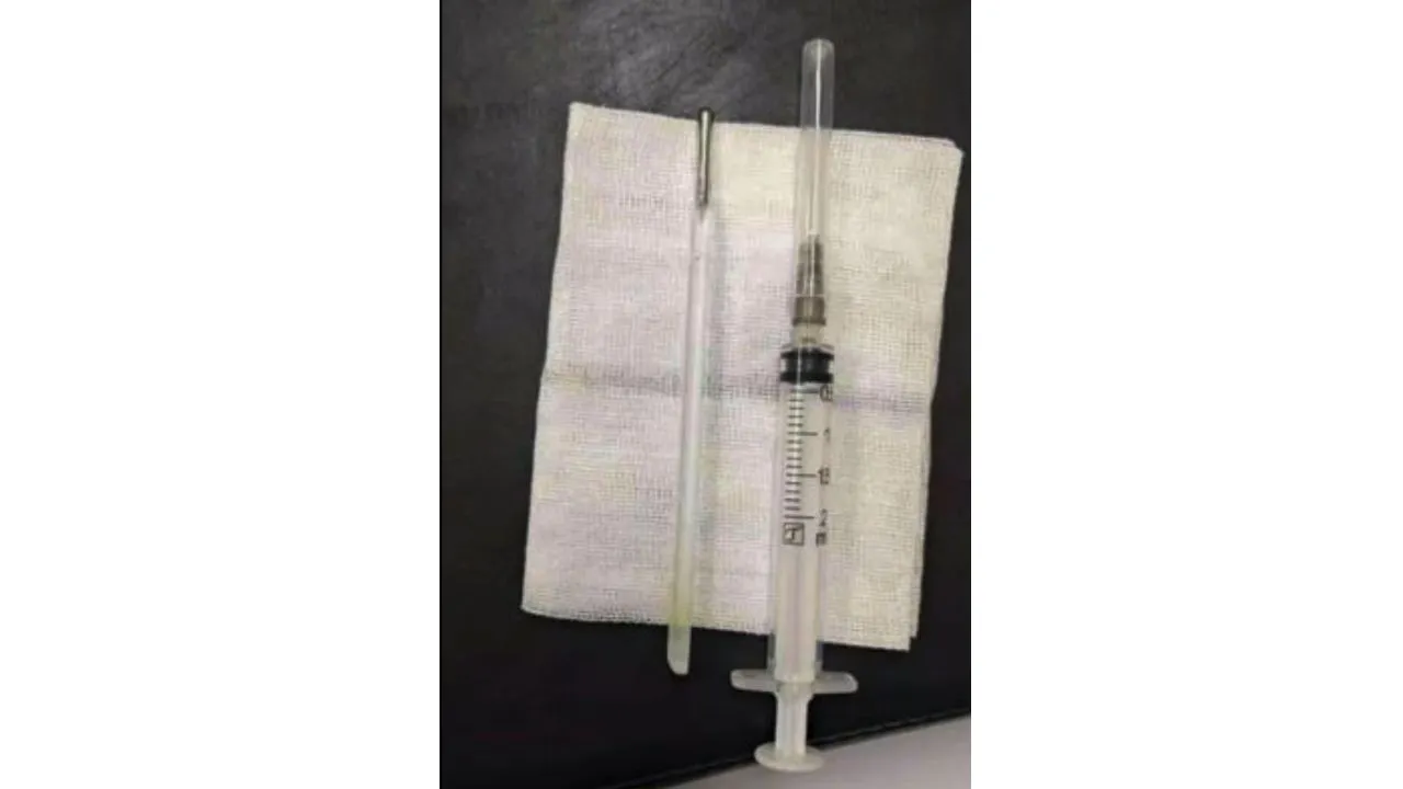 Objeto encontrado en el intestino delgado del hombre.