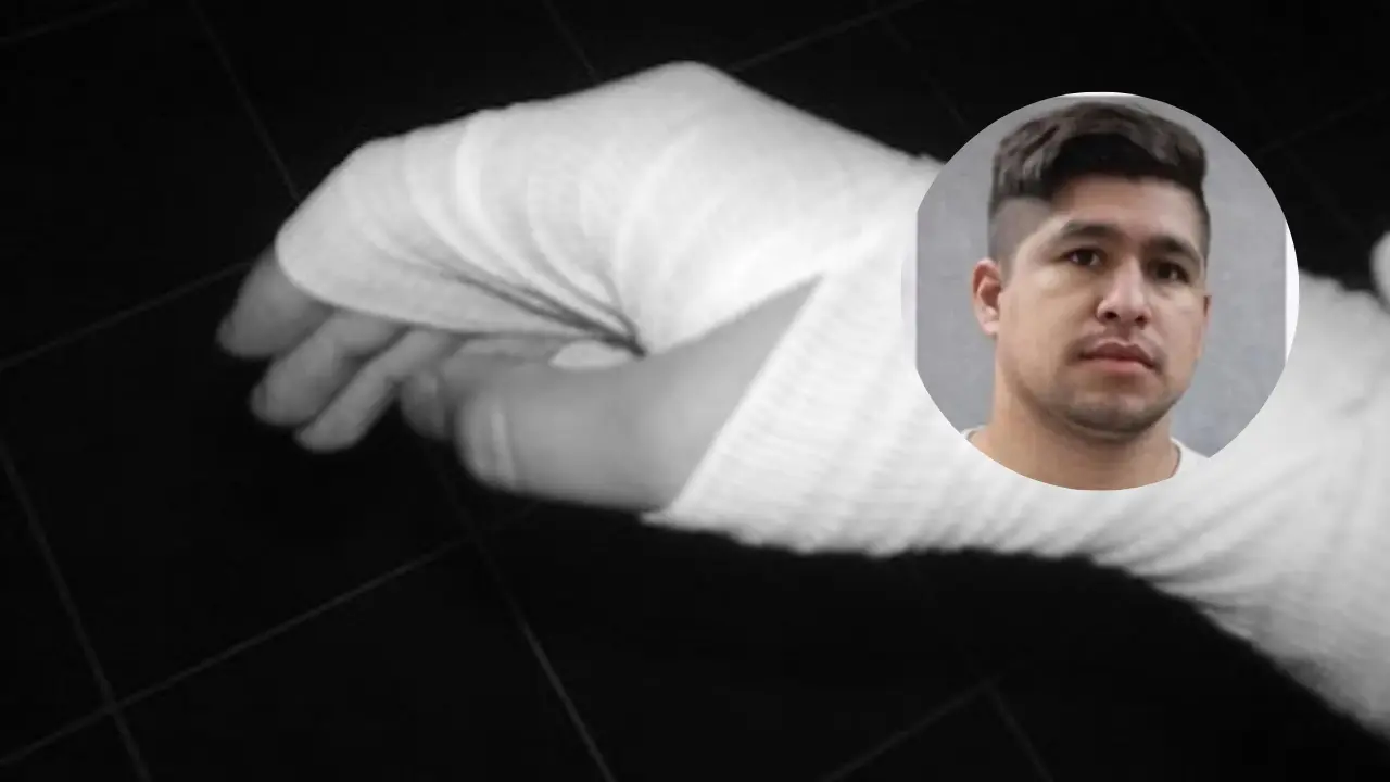 Imagen de Hombre le cortó las manos a su expareja frente a sus hijos; ella está grave