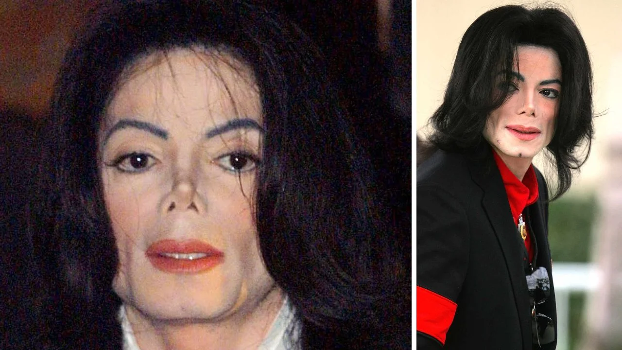 Imagen de ¿Michael Jackson tenía cáncer? ¿Qué enfermedad tenía, qué es vitiligo?