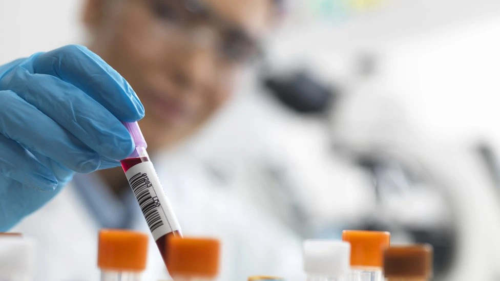 Imagen de referencia de una prueba de VIH.