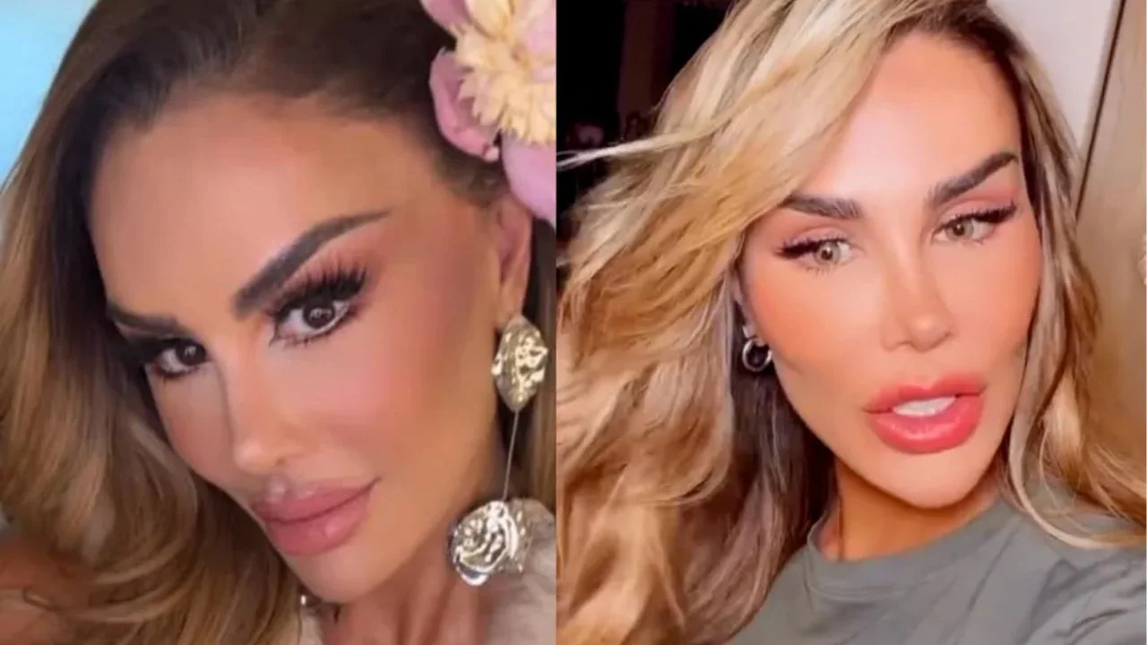 El antes y después de su cambio estético.