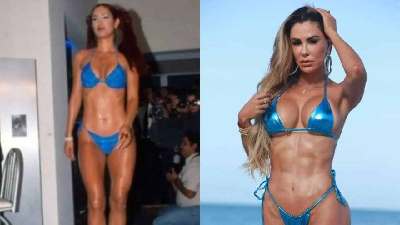 Las cirugías de Ninel Conde