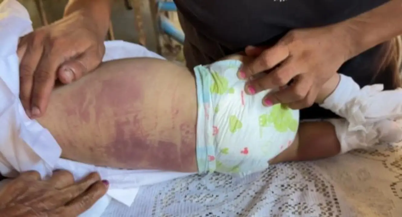 Bebé que murió tras vacuna hexavalente