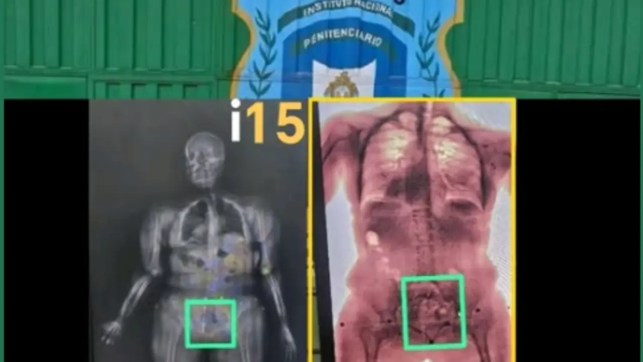 Muestras de rayos x de dos mujeres