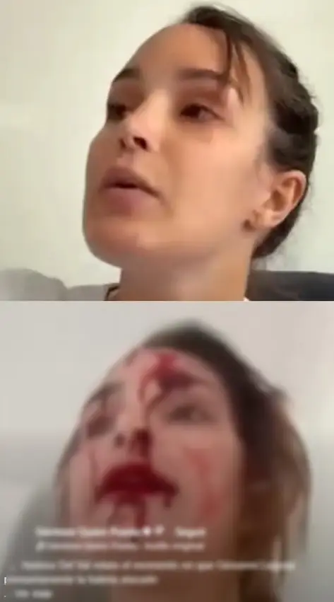 Miss Venezuela, agredida por estilista
