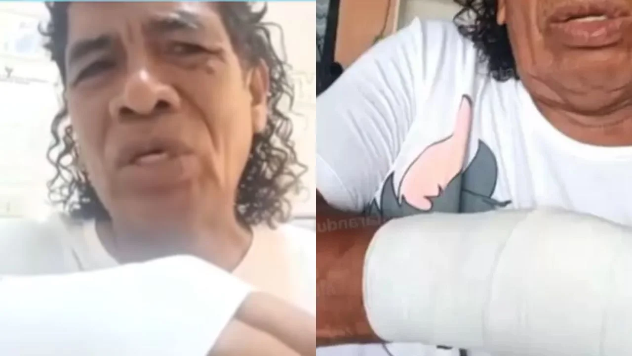 José Luis Cachay Ramos con su brazo enyesado