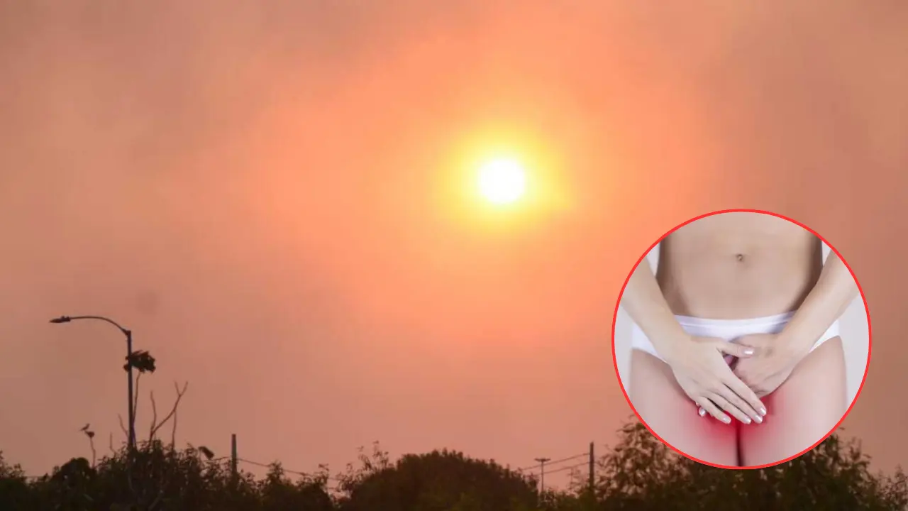 Ola de calor en Honduras provoca aumento de infecciones vaginales, advierten Imagen de Ola de calor en Honduras provoca aumento de infecciones vaginales, advierten