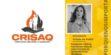 Imagen de Fundación CRISAQ transforma vidas de sobrevivientes de quemaduras en Honduras