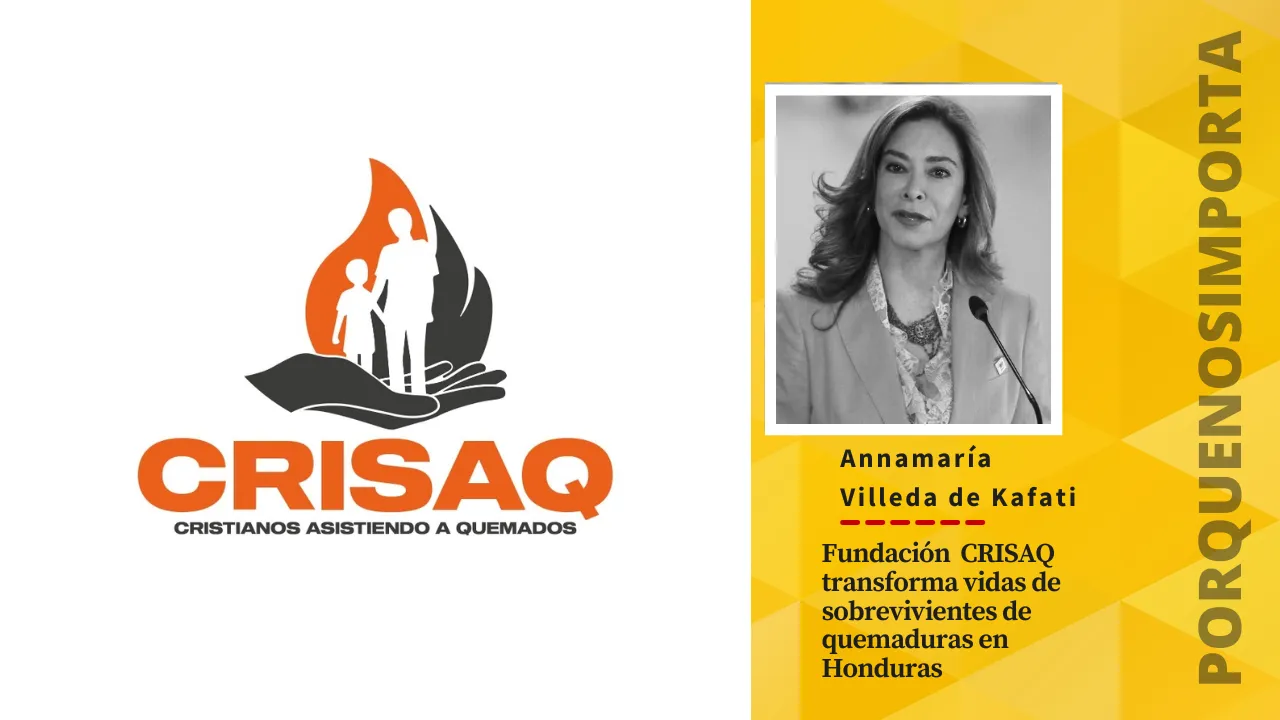 Fundación CRISAQ transforma vidas de sobrevivientes de quemaduras en Honduras Imagen de Fundación CRISAQ transforma vidas de sobrevivientes de quemaduras en Honduras
