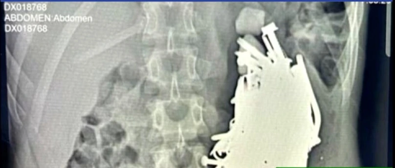 Radiografia
